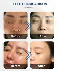 3 Handles Body Face Eyes Slimming Vacuum Suction Cavitation Radio Frequency