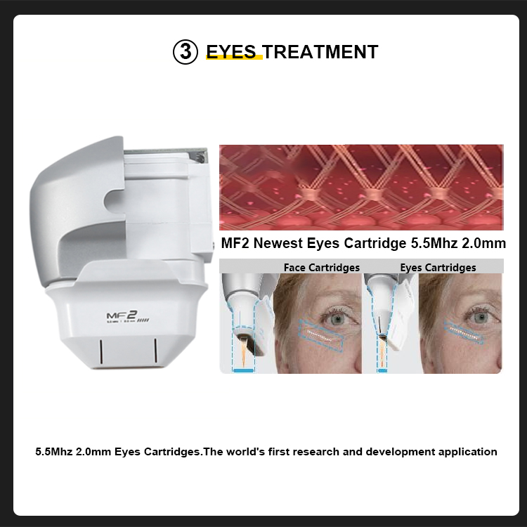 The 7D HIFU machine is a non-invasive beauty device that can provide local or comprehensive facial care using High Intensity Focused Ultraso (5)