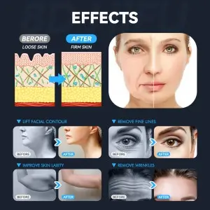 5 – in – 1 8D HIFU Anti – Aging Machine: Your All – in – One Beauty Solution