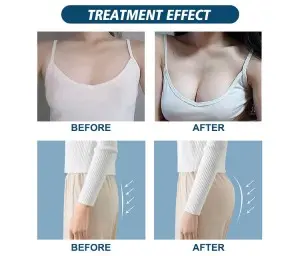 Portable vacuum therapy breast buttock enlargement machine cupping