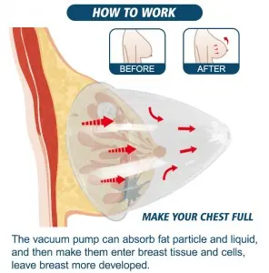 Portable vacuum therapy breast buttock enlargement machine cupping