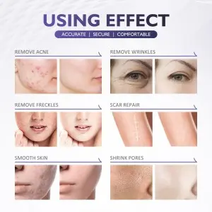 2-in-1 Cold Plasma Beauty Machine – Advanced Skin Rejuvenation & Repair System