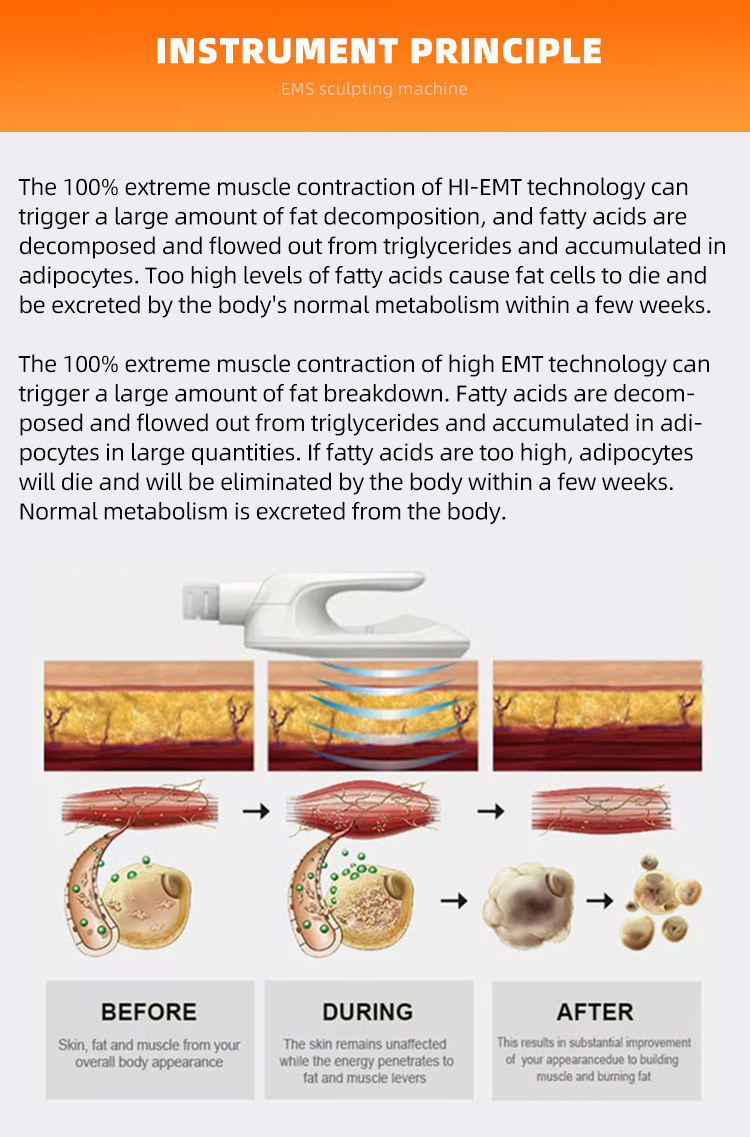 EMS machine is a motion e muscle contraction and achiev (7)