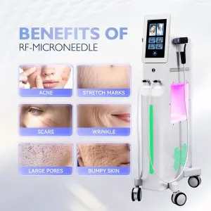 RF – Microneedle Beauty Device: Transform Your Skin
