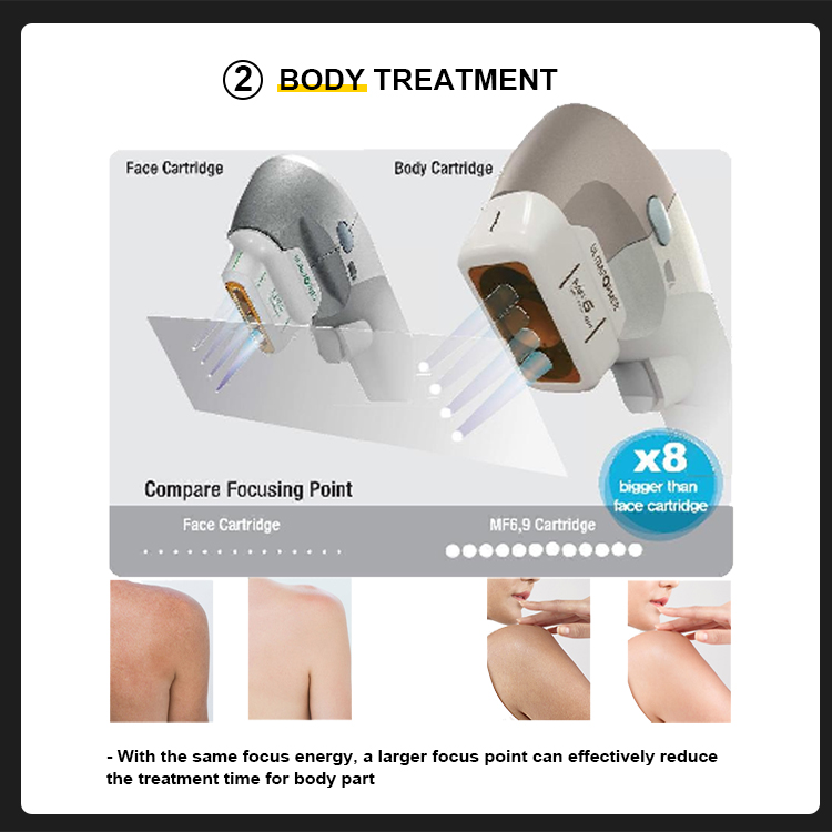 The 7D HIFU machine is a non-invasive beauty device that can provide local or comprehensive facial care using High Intensity Focused Ultraso (4)