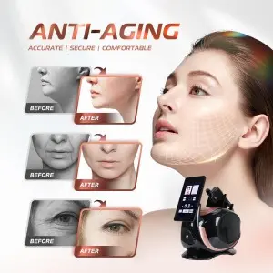 Transform Your Skin with Our 2 – in – 1 HIFU & RF Skin Tightener