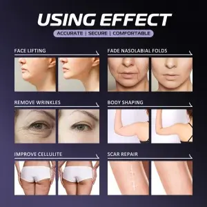 2 – in – 1 HIFU Machine: Your Key to a Youthful Look
